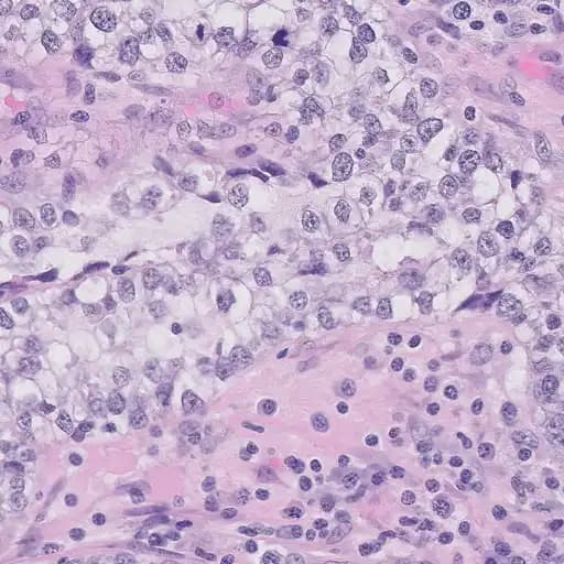 Beispiel eines extrahierten Patches