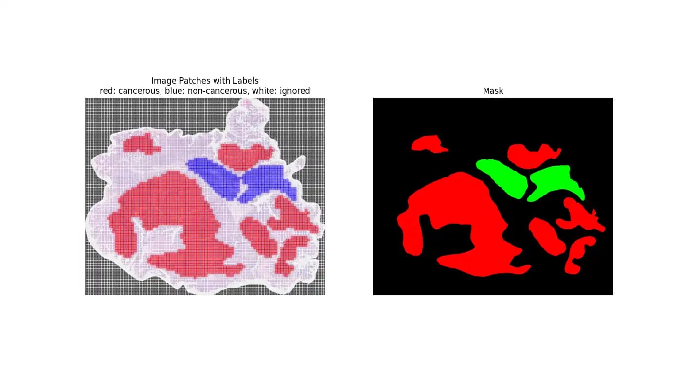 Patch Generierung mithilfe der Segmentierungsdaten