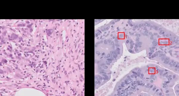Zellkern Abnormalitäten